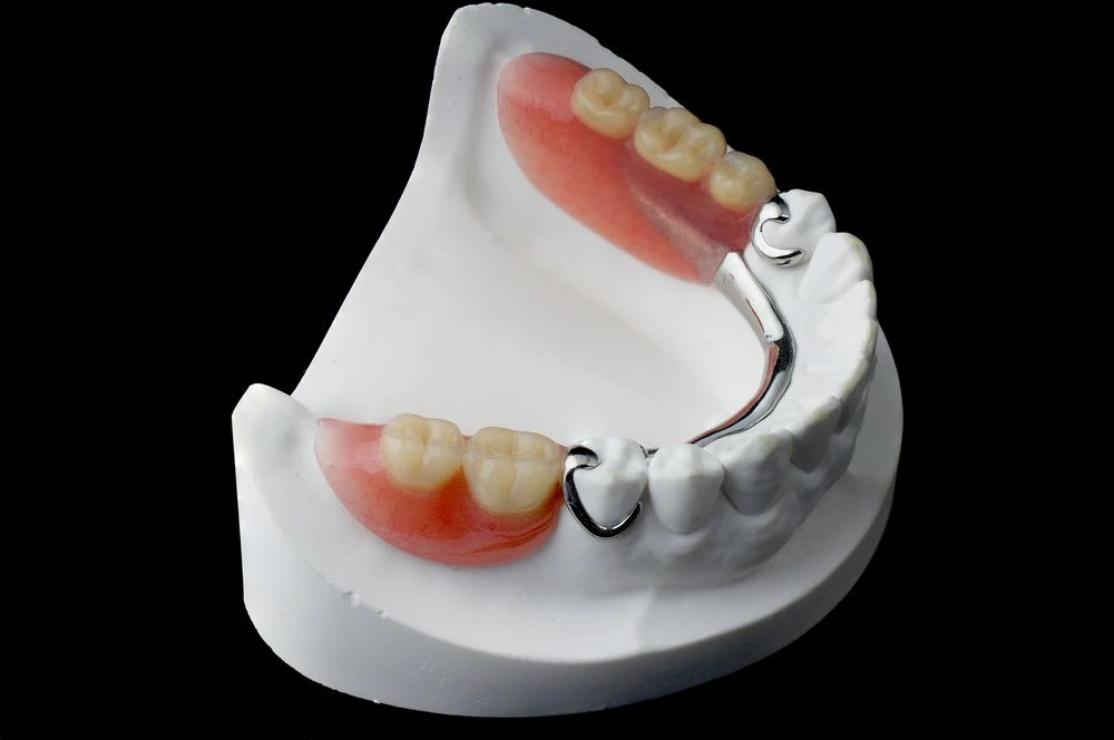 Removable Aesthetic Prostheses